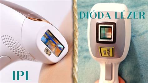 Dióda lézeres szőrtelenítés folyamata