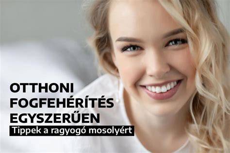 otthoni fogfehérítés infografika