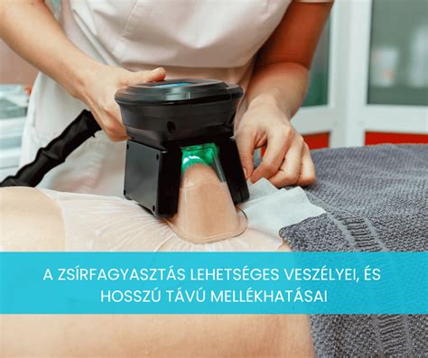 előtte-utána hajkiegyenesítés