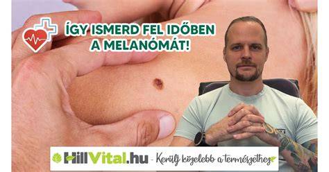 Infografika: Melanóma stádiumai és Breslow-szintjei
