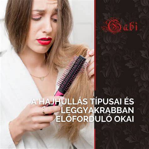 ábra a hajhullás típusairól