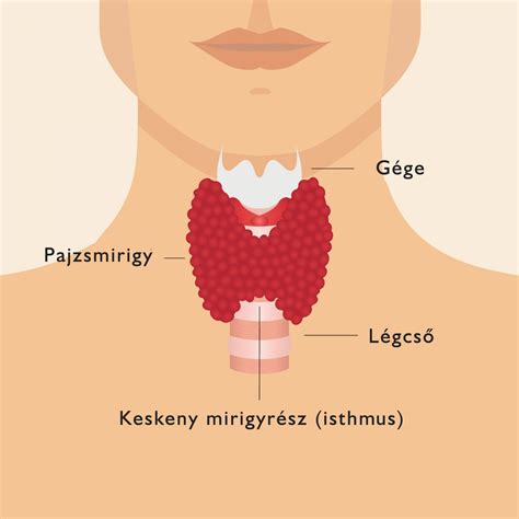 Illusztráció a fejbőr-akné tüneteiről