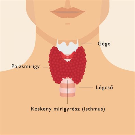 Infografika a fejbőr-akné tüneteiről és okairól