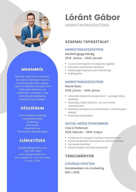 Férfi hajhullási minták