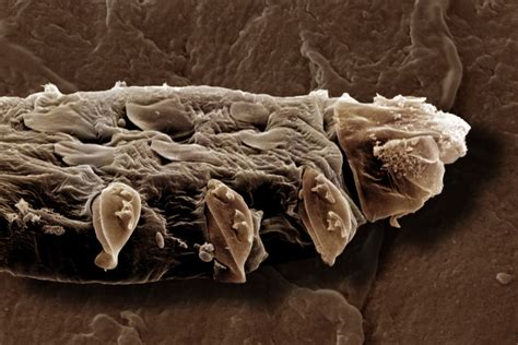 Demodex atka mikroszkóp alatt