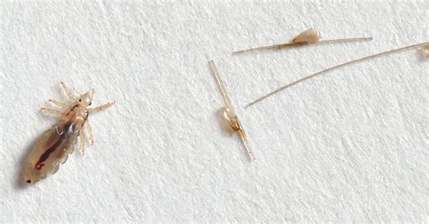 fejtetű és serke a hajszálon