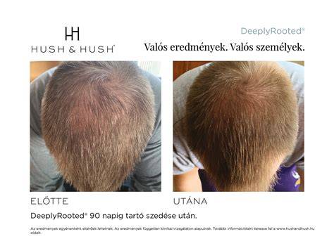 Vibráló karmazsinvörös hajszín előtte-utána kép