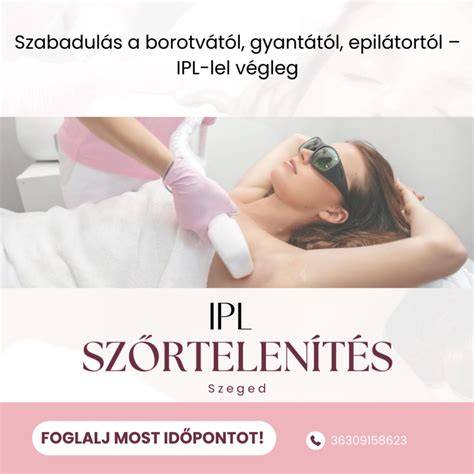 Infografika az IPL és HPL technológiák összehasonlítása