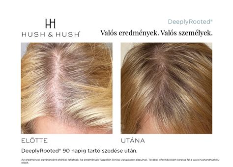 hajfestés előtte-utána összehasonlítás