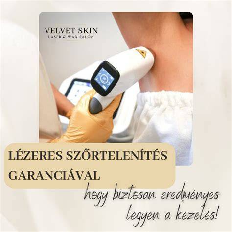 szőrtelenítő szalon vizuális áttekintés