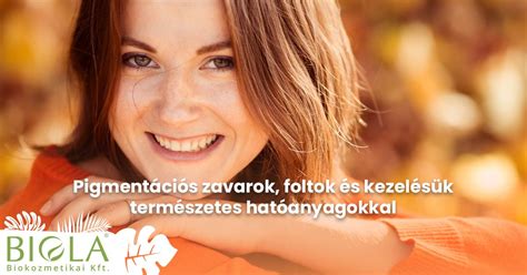 Őszhajfedésre és pigmentációs sorozatra vonatkozó diagram