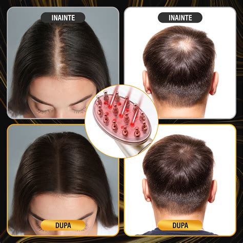 Hajhullás elleni kezelés