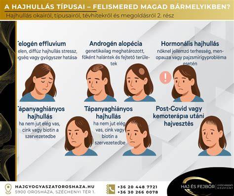 Infografika a foltos hajhullás okairól és kezelési lehetőségeiről