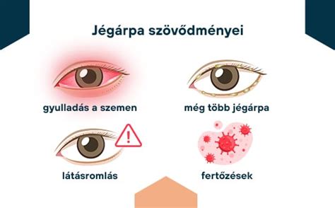 A szemhéjgyulladás tüneteit ábrázoló illusztráció