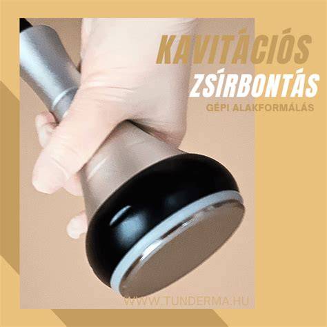 Kavitációs zsírbontás technikai ábra