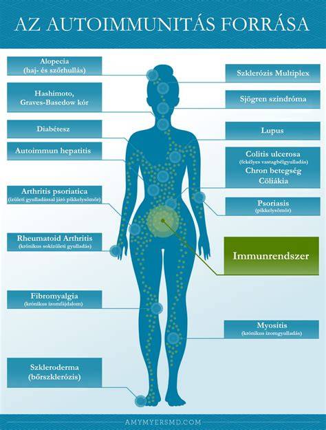 Infografika az autoimmun betegségek és hajhullás kapcsolatáról