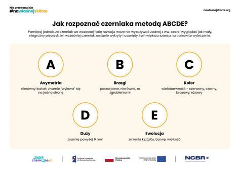 infografika az ABCDE szabályról