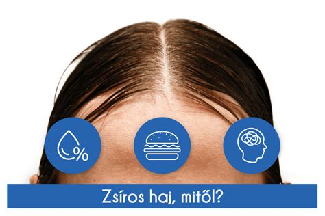 foglyos fejbőr zsírprobléma infographic