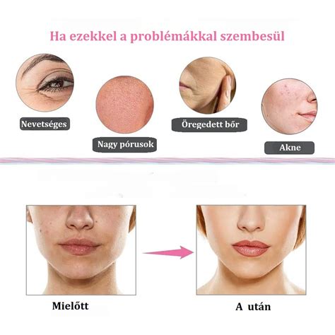 Bőrfiatalító kezelés