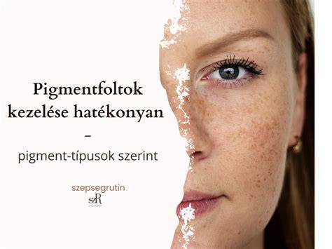 diagram szőrszál pigment és kezelés összefüggés