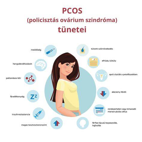 PCOS diagnózis és kezeléséhez vezető lépések - vizsgálatok és képalkotókkal