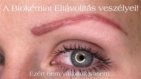 szemöldökfesték eltávolítás terv diagram