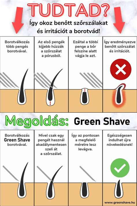 Infografika a benőtt szőrszálak megelőzéséről