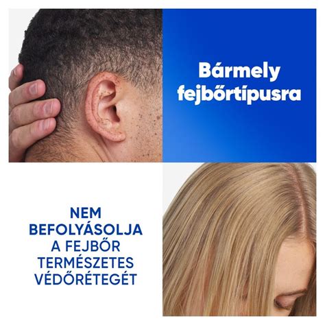 Fejbőr elemzése korpásodás esetén