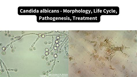 A Candida albicans mikroszkópos képe
