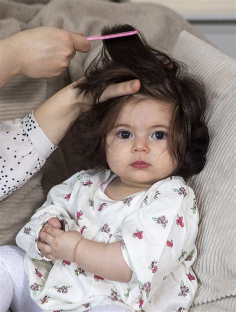 Egészséges, dús hajú emberek