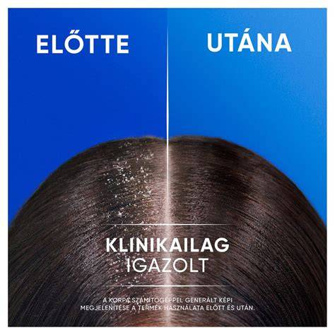 Korpásodás és bőrápolás vizuális diagram