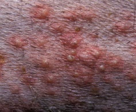 Kutya bőrbetegségek diagnosztizálása