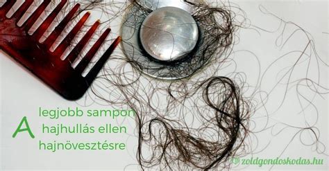 Hajhullás elleni samponok összehasonlítása
