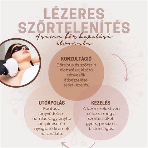Infografika: IPL és lézer közötti különbségek, bőrtónus és szőrszín összefüggése