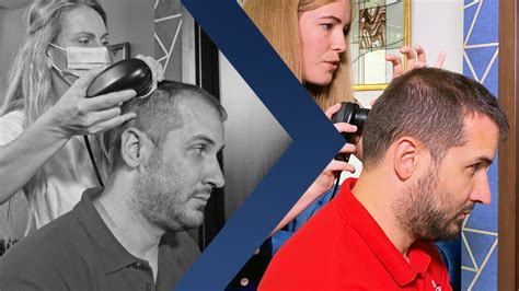 mikrokamerás fejbőr vizsgálat