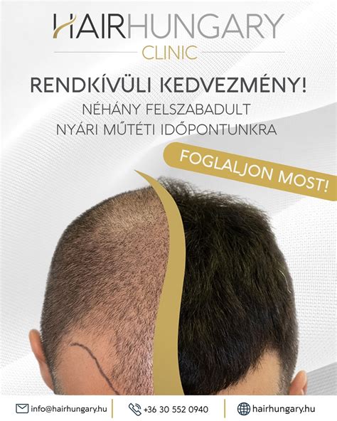 hajbeültetés klinika Budapest