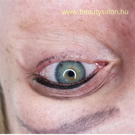 Tisztítási folyamat szemhéj atkák