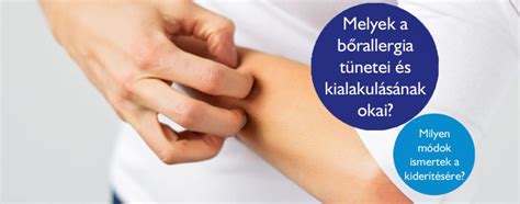 A korpa kialakulásának okai és tünetei