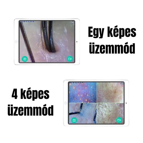 Kép a fejbőr és haj egészségéről