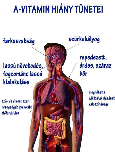 A-vitamin-hiány tünetei