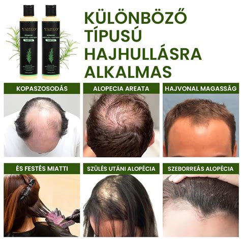 hajnövekedést serkentő hatás