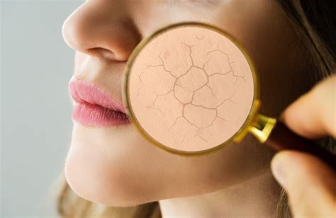 érzékeny bőr okai