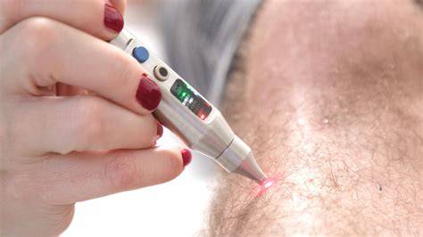 SoftLaser_Biostimulacio.jpg