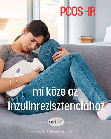Infografika: PCOS és fokozott szőrnövekedés összefüggése