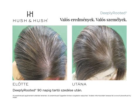 Szárazsampon hatása: előtte-utána összehasonlítás