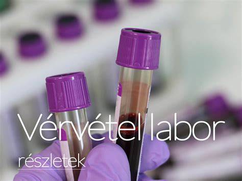 anyagajegy vizsgálat és szűrés