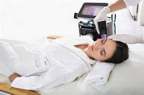 RF- és IPL-alapú bőrfiatalítás és pigmentációs kezelés vizuális összefoglalója