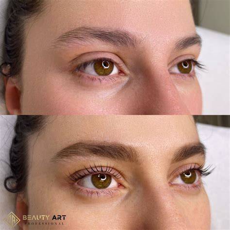 A Lash Lifting eljárása diagram