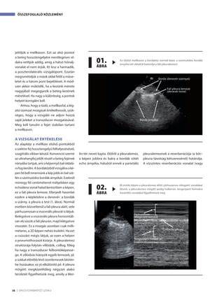 Informatív szemöldökápolási ábra: formázás, szőkítés, takaró vonalak