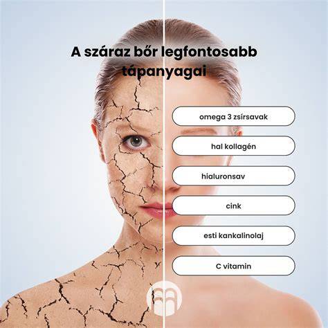száraz bőr és pajzsmirigy összefüggése infografika